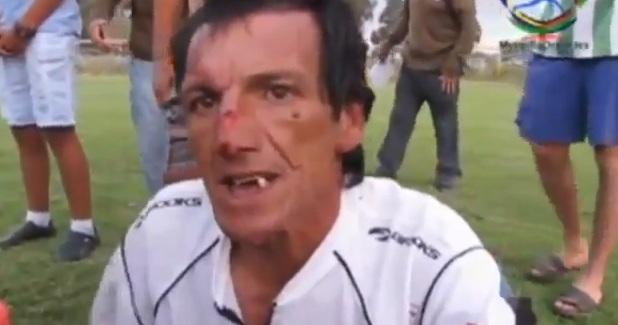 Ξύλο δίχως έλεος σε διαιτητή στη Χιλή (video)