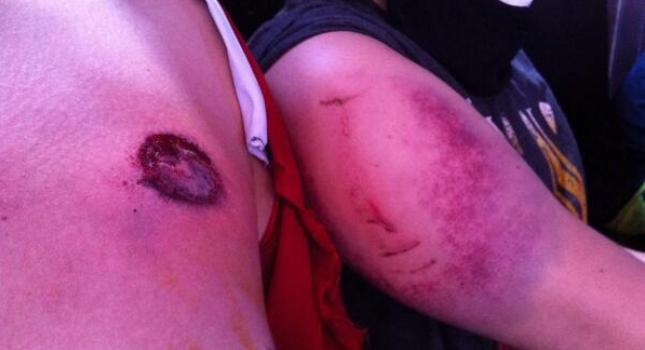 Τραυματίες δημοσιογράφοι από πλαστικές σφαίρες στην πλατεία Ταξίμ
