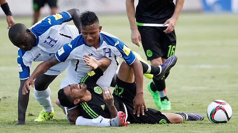 Σοκάρει ο τραυματισμός παίκτη της Ονδούρας (pics/video)