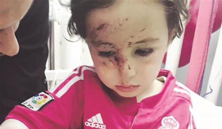 Ο Ρονάλντο συναντά τρίχρονο που επέζησε από βομβιστική επίθεση (pics)