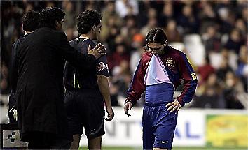 Εκτός για ένα μήνα ο Μέσι, χάνει το «ελ κλάσικο»