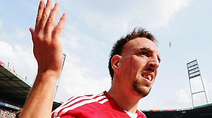 Επιστρέφει ο Ριμπερί