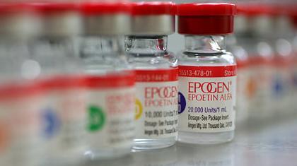 ΠΕΚΙΝΟ 2008: Τα δείγματα ξανά στο μικροσκόπιο