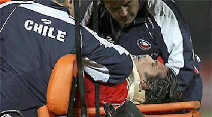 Ρήξη χιαστών ο Μαρκ Γκονζάλες