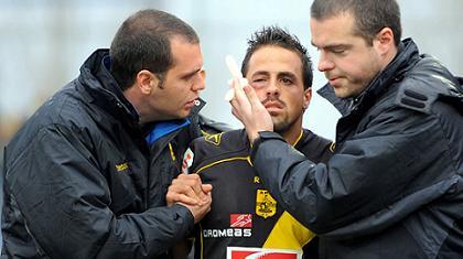 ΑΡΗΣ: Κάταγμα ζυγωματικού ο Βιτόλο