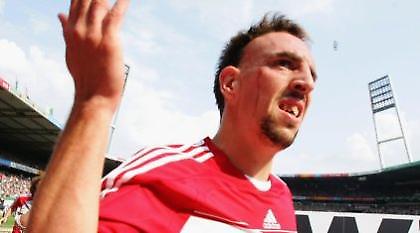 Ο Ριμπερί απειλεί με αποχώρηση!