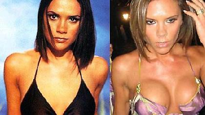 Κουράστηκε να τα… κουβαλά η Βικτόρια