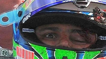 Εκτός αγώνα ο Μάσα!