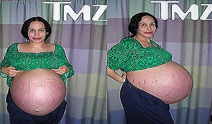 Δωδεκάδυμα προ των πυλών!