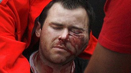 Σε κρίσιμη κατάσταση ο οπαδός της Τουλούζ