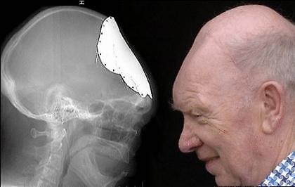 Αυτό το κρανίο...«τα σπάει»!