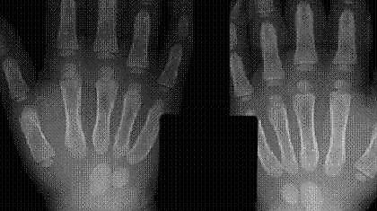 Δείξε μου το χέρι σου, να σου πω πόσο είσαι!