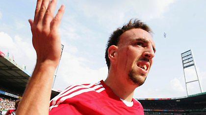 Αποφεύγει το νυστέρι ο Ριμπερί