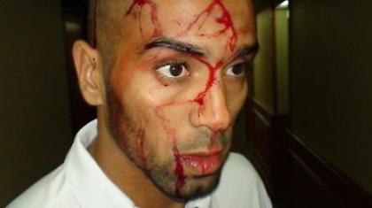 Επίθεση κατά Τζεμπούρ και συμπαικτών του στην εθνική Αλγερίας (video)