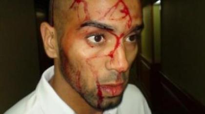 Σε «πολεμικό» κλίμα το Αίγυπτος-Αλγερία