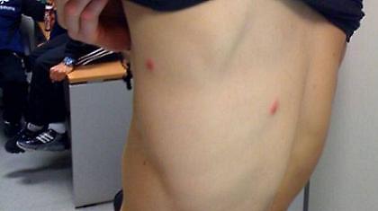 Με αεροβόλα και σημάδια…