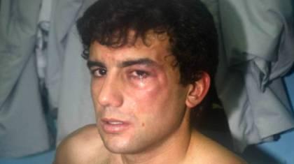 Επεισόδιο Εστογιανόφ - Αραούχο