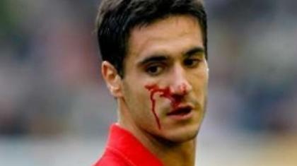 Χάνει Ιμπάνιεθ η Ατλέτικο