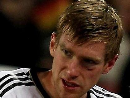 Χάνει και Τότεναμ ο Μερτεζάκερ (pics)