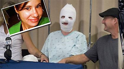 Εκαψε μόνη της με οξύ τον εαυτό της! (video)