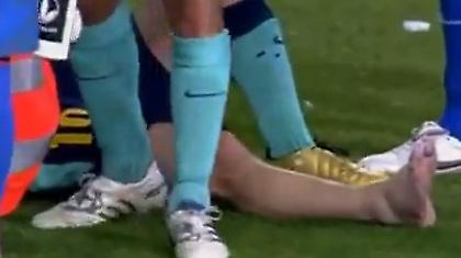 Σοκάρει ο τραυματισμός του Μέσι (video)