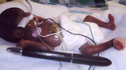 Γέννησε, ενώ βρισκόταν σε κώμα!