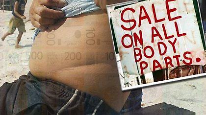 «Αφήστε μας να πουλήσουμε τα όργανά μας!»