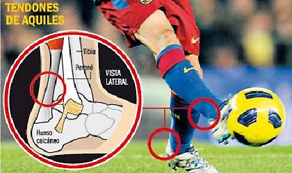 Αυτό είναι το πρόβλημα του Τσάβι