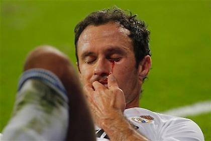 Τραυματίας ο Καρβάλιο