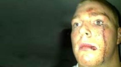 Γλίτωσαν τα χειρότερα...