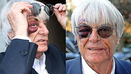 Το μαύρο μάτι του Έκλεστοουν (pics)