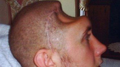 26χρονος έμεινε με μισό κεφάλι!