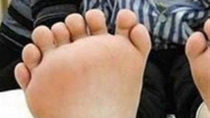 Μωρό με 26 δάχτυλα