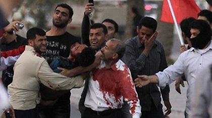 Μπαχρέιν: Η αστυνομία άνοιξε πυρ κατά διαδηλωτών