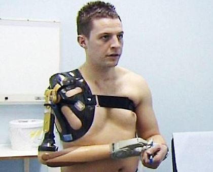 Ο πρώτος βιονικός Άγγλος