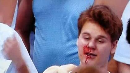 Του «έσπασε» τα μούτρα η μασκότ! (video)