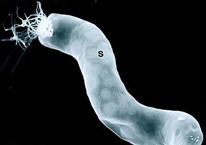 Βρέθηκε εξωγήινο βακτήριο!