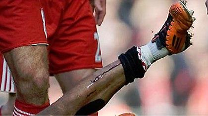 Αυτή η ήττα θα τον σημαδέψει… (pics)