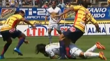 Εφιαλτικός τραυματισμός ποδοσφαιριστή (video)