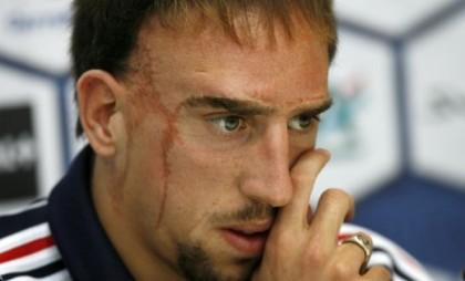 Ριμπερί: «Ασήμαντος ο Φαν Γκάαλ»