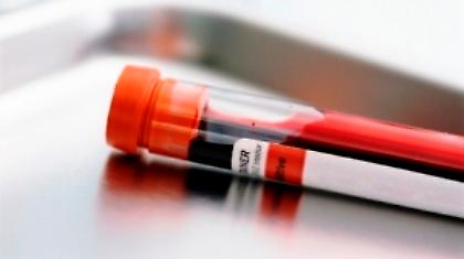 «Ξεκλειδώνεται» το γονιδιακό ντόπινγκ