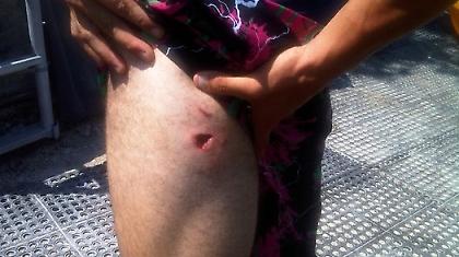 Η πρώτη επίθεση κροκόδειλου στις ΗΠΑ