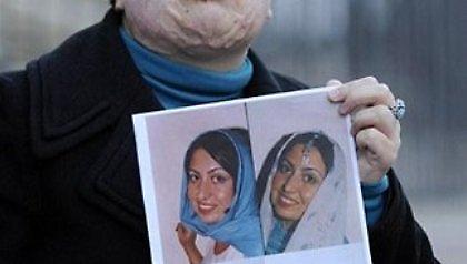 Ιρανικό δικαστήριο εγκρίνει την επίθεση με οξύ