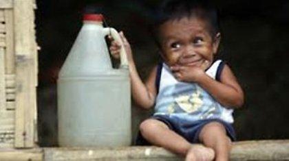 Ο πιο κοντός άνθρωπος στον κόσμο