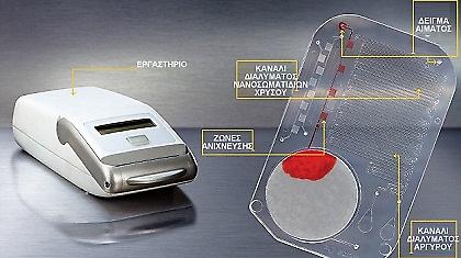 Επαναστατική «κάρτα» θα διαγνώσκει το AIDS μέσα σε 15 λεπτά