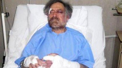 Του έσπασαν τα χέρια γιατί δεν άρεσαν τα σκίτσα του στον Ασάντ