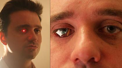 Έχει βιντεοκάμερα στο μάτι! (video)