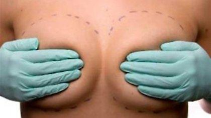 Τα εμφυτεύματα στήθους της έσωσαν τη ζωή!