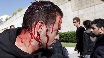 Χαρακτηριστικές φωτογραφίες από τα σημερινά επεισόδια