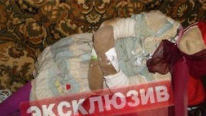 Έκλεβε πτώματα για να… φτιάχνει κούκλες